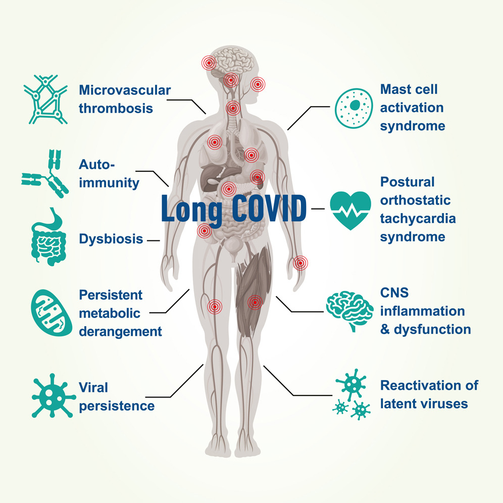 Long COVID’s Lasting Toll: Lives Changed, Systems Failing